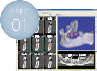 merit01